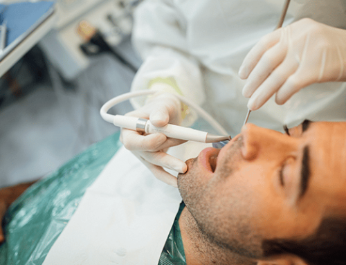 ¿Qué factores se tienen que tener en cuenta para hacerte un implante dental?